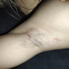 My Armpits