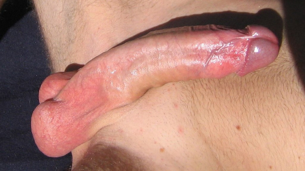 My penis #30