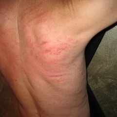 Spanking