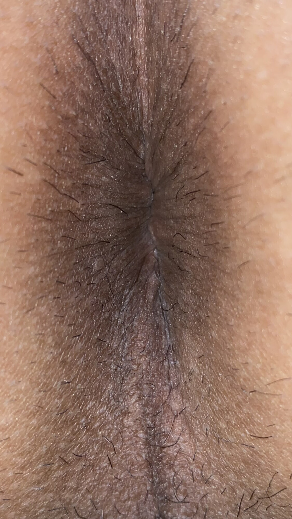 Close-up of a man&#039;s anus #21