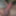 My penis before tugging 2025 #17