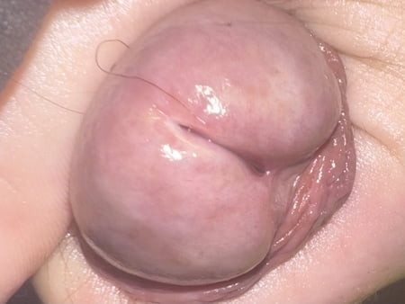 Head