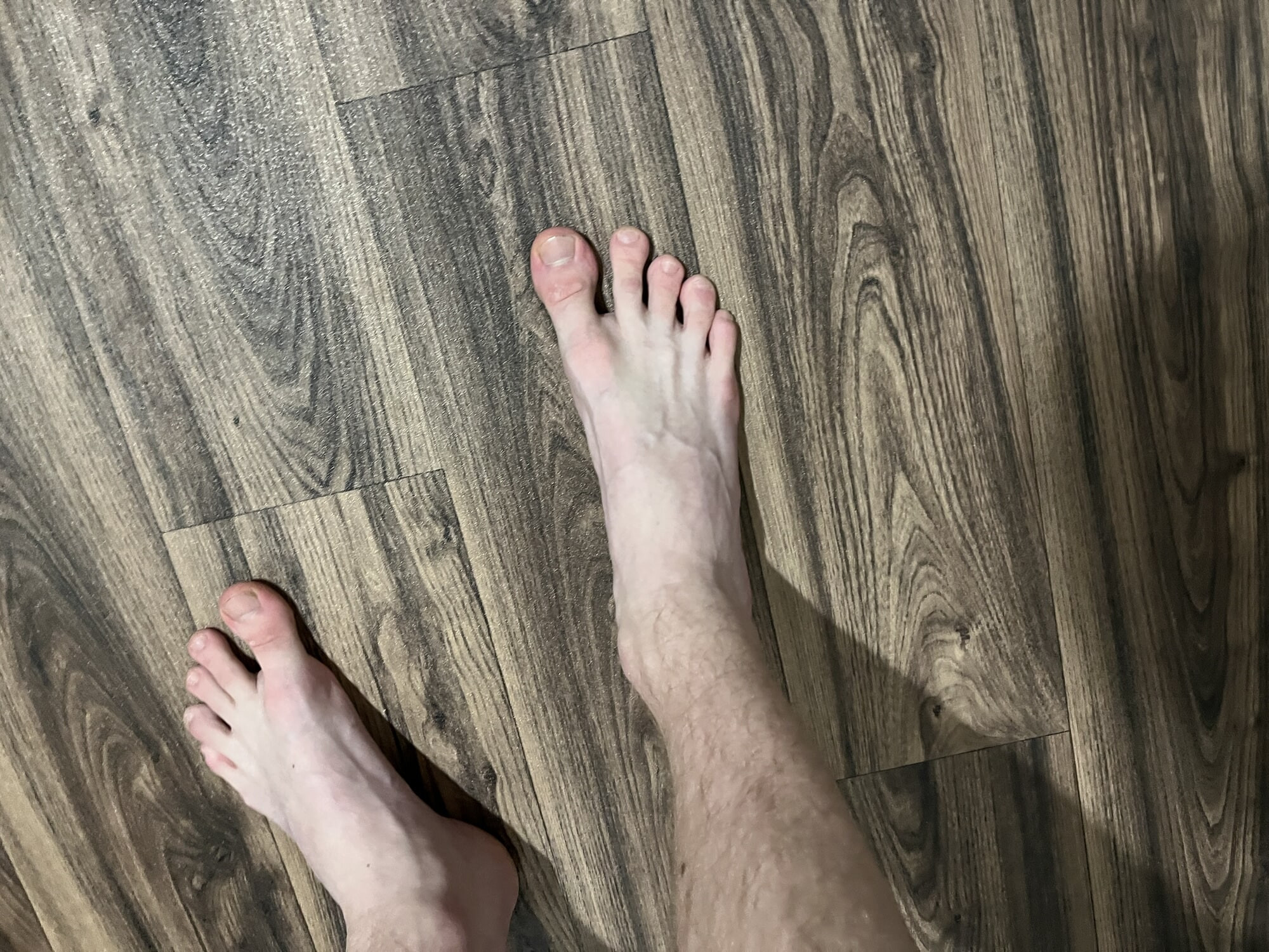 My feet #11
