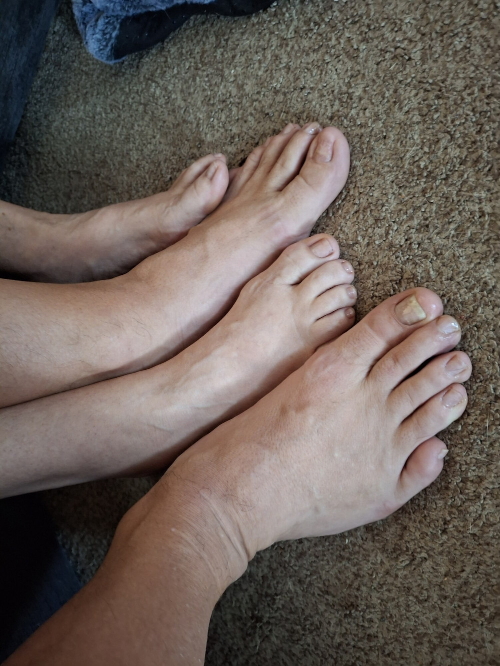 Showing off our un polished toes #5