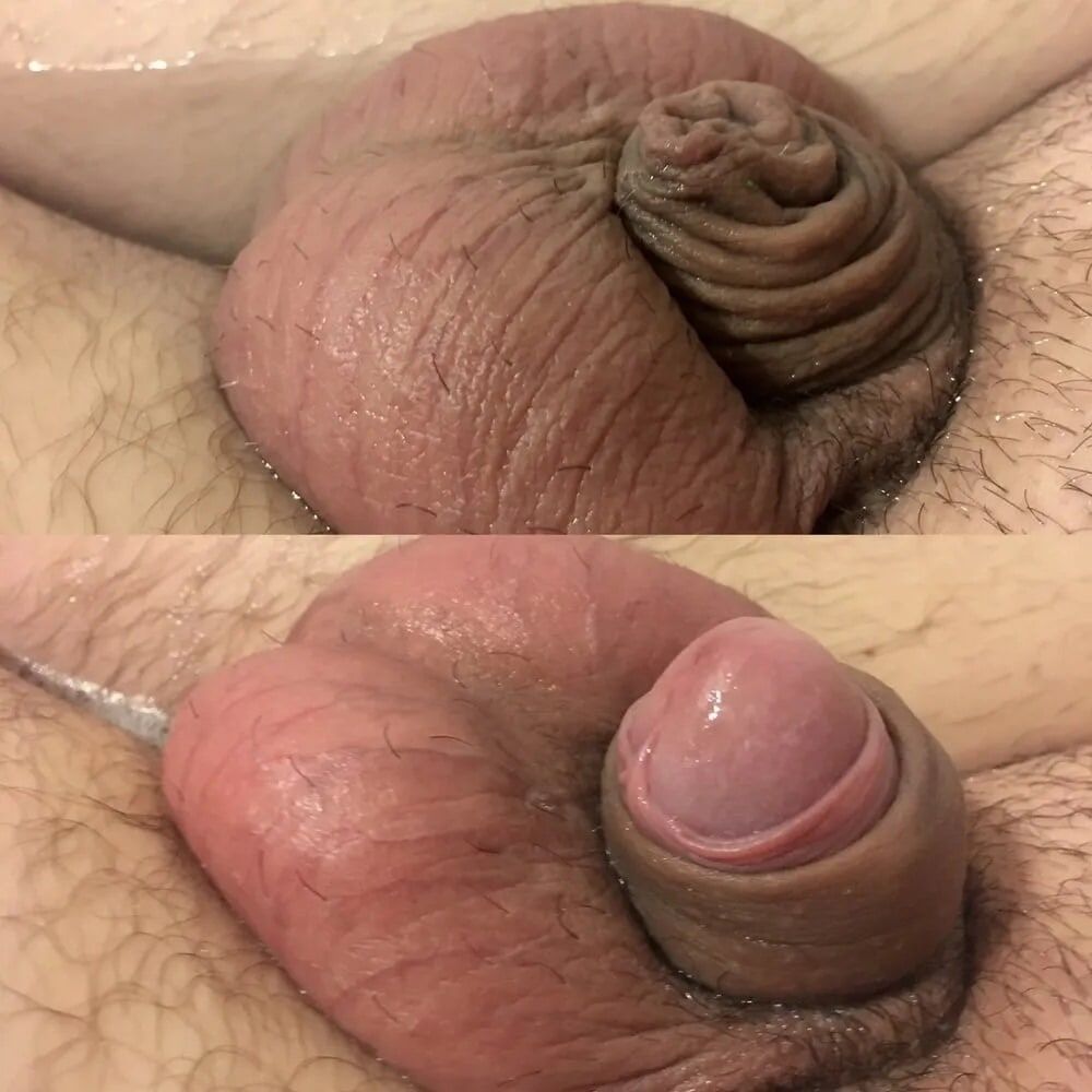 My micropenis  #2