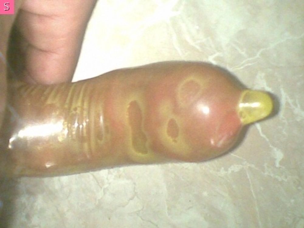 May dick #35