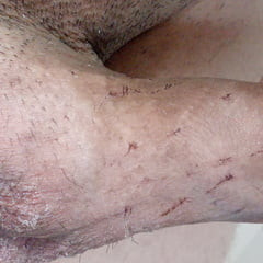 4 days after the spiked chastity cage