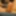 The head of the penis without the foreskin 