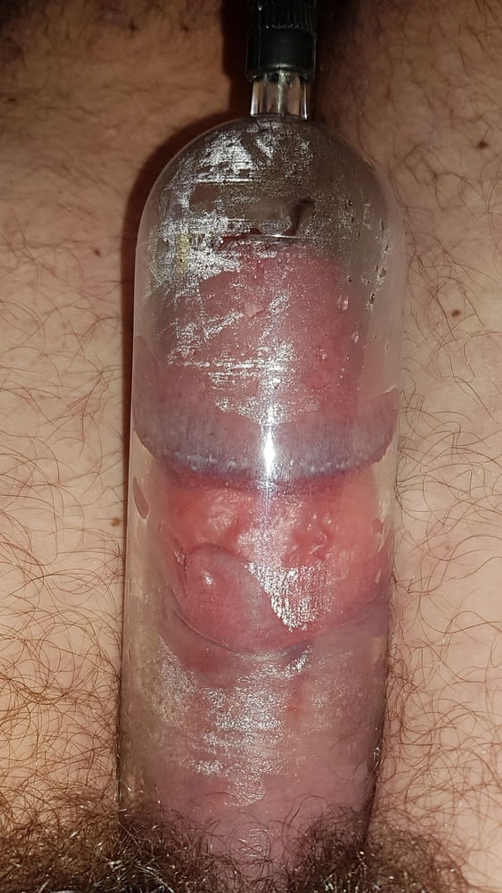 Penis pump #39