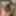 extended foreskin #4
