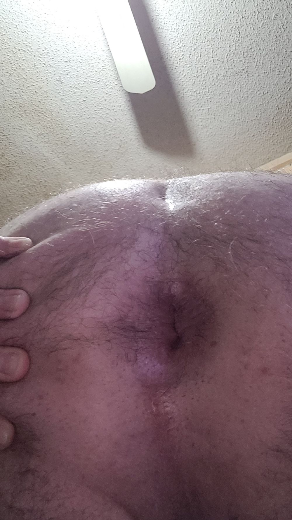 My hairy butthole #5