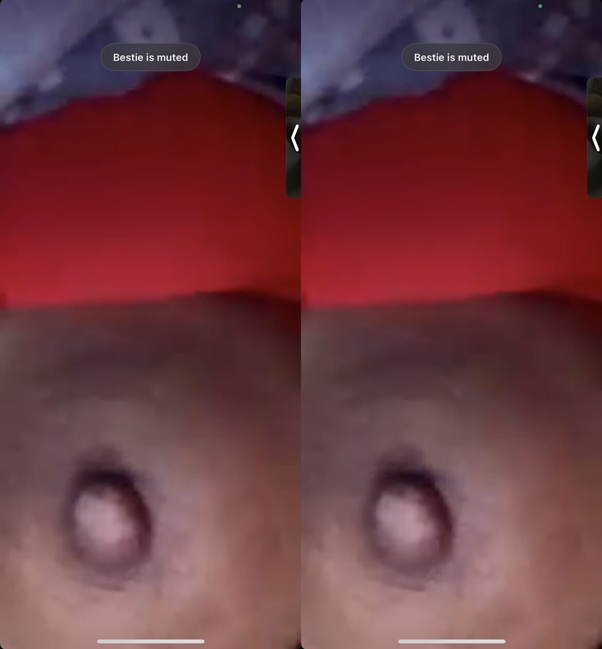 My nipple