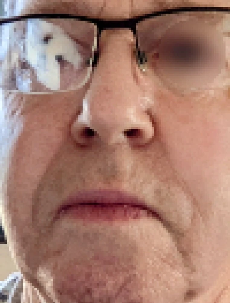 Cleaning my glasses  #6