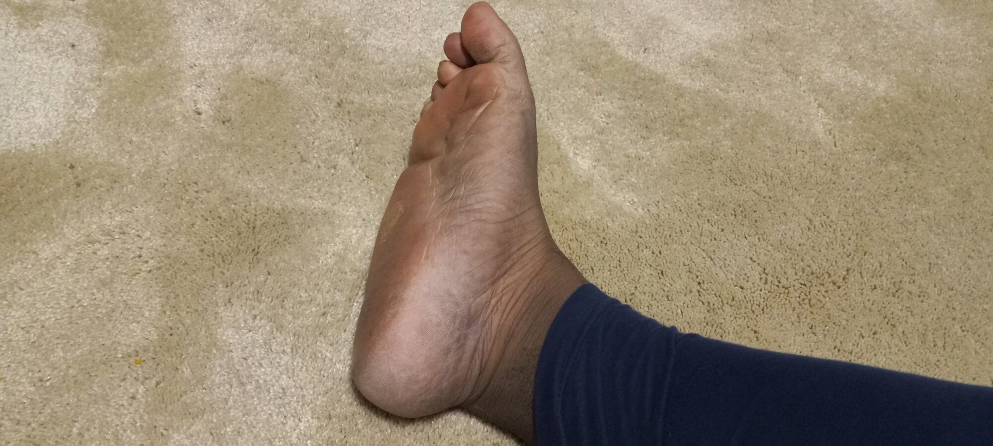 Pics of my Feet #8