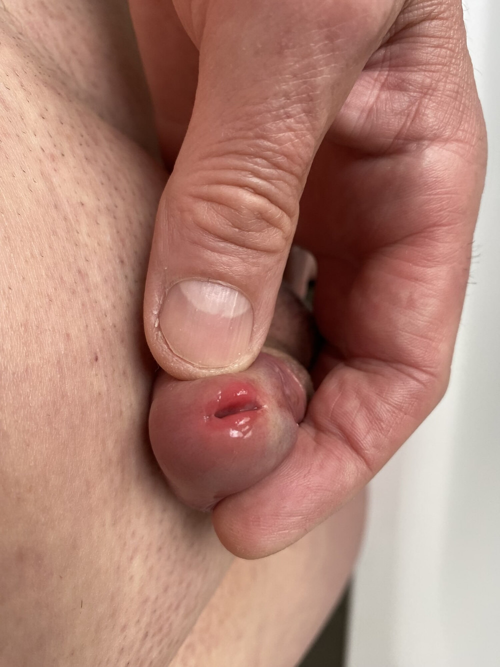 small Penis #2