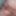 Close up foreskin and glans #2