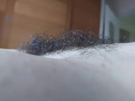 Hairy         