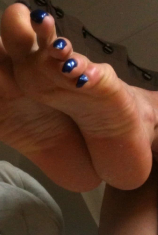 blue toenails and soles feet after day at beach  #47