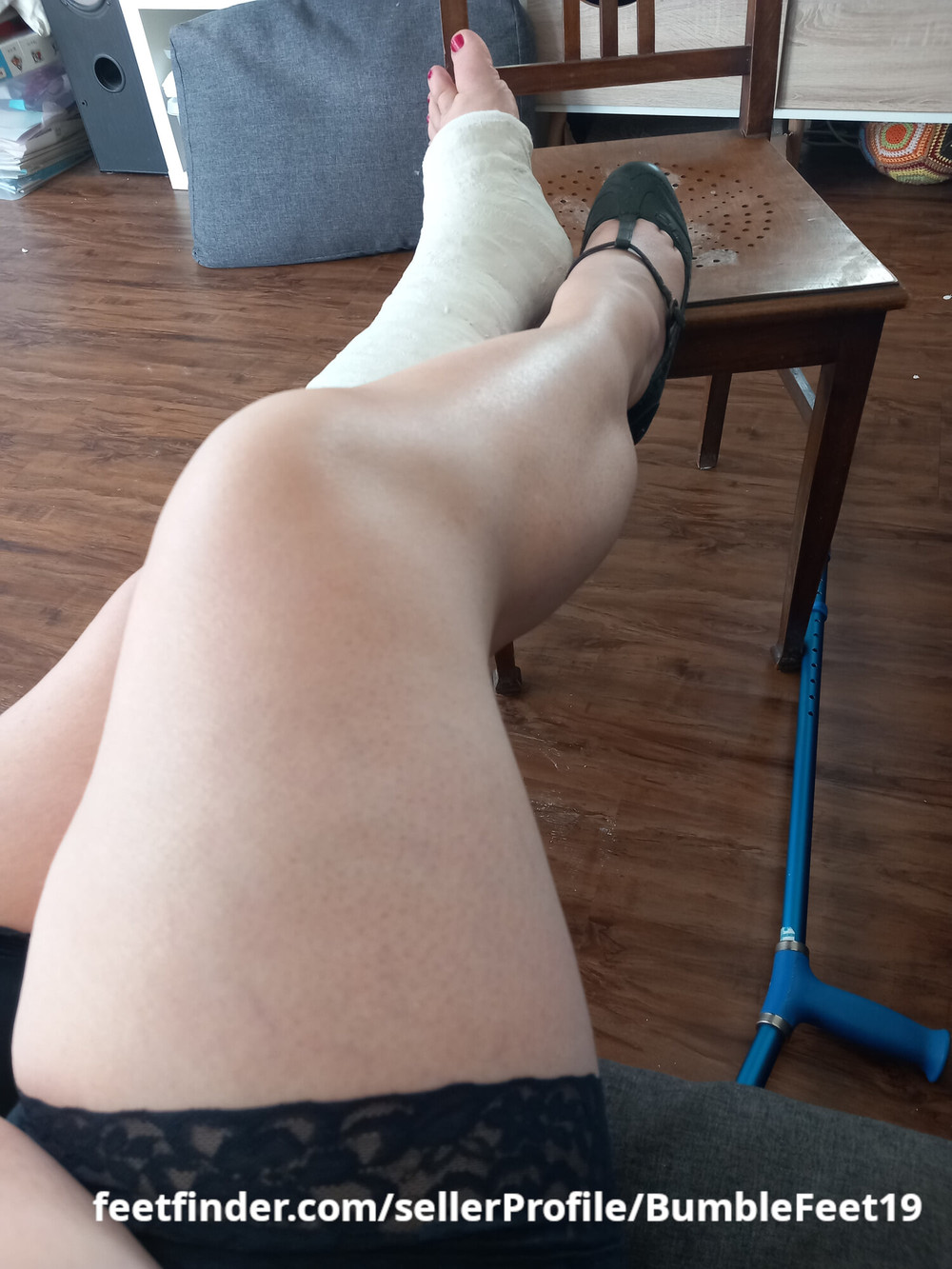 Session: Applying a short leg cast (SLC) on my left leg #7