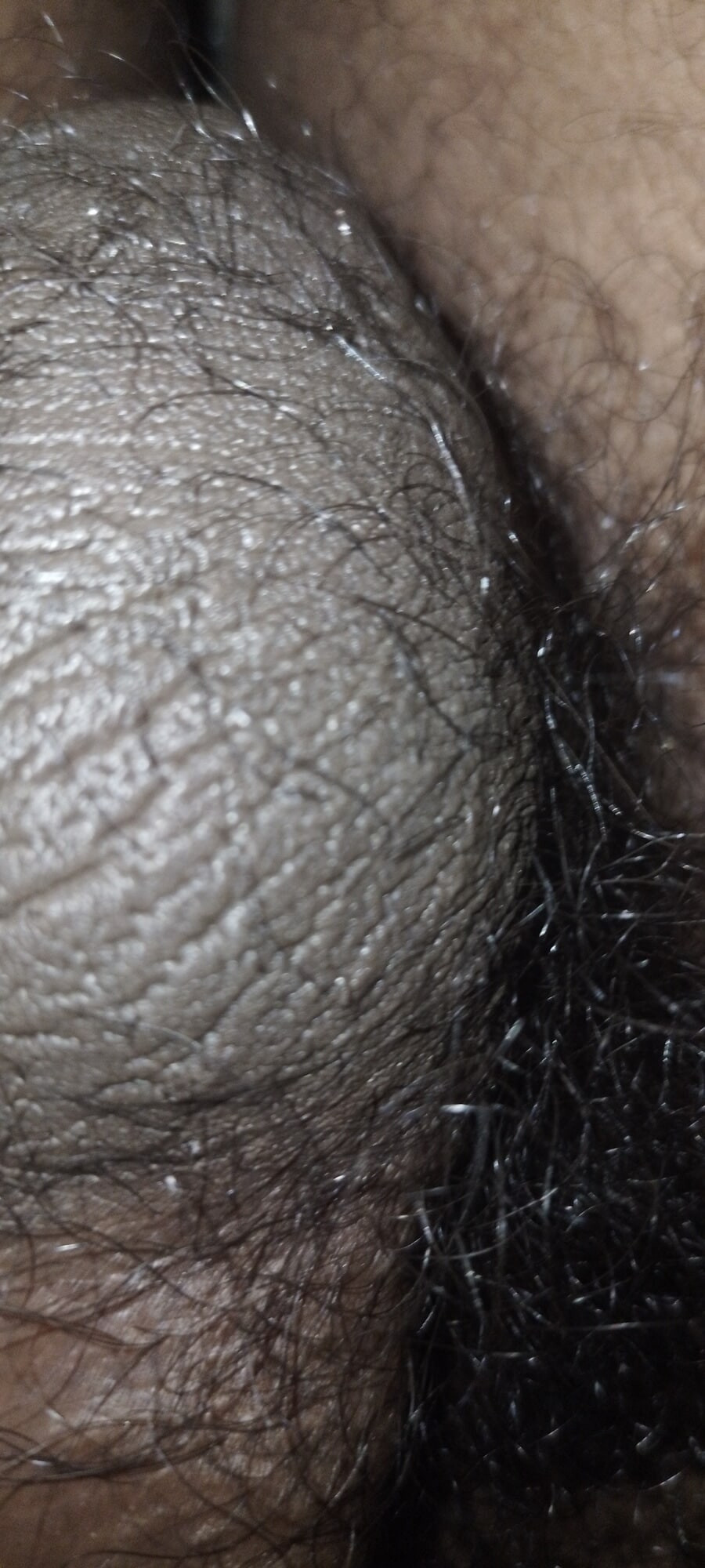 My Unerected Uncut Dick