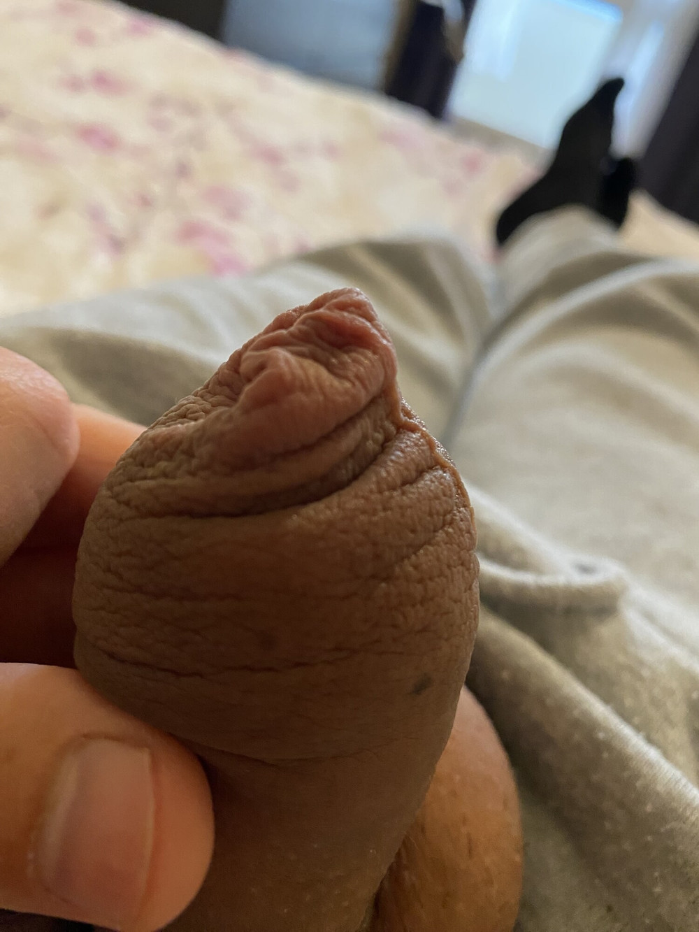 Very loose foreskin #2