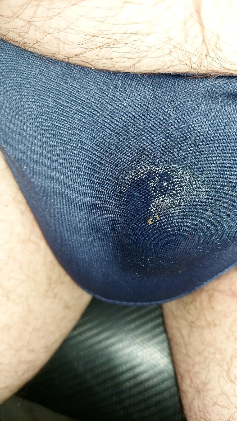 ich #6