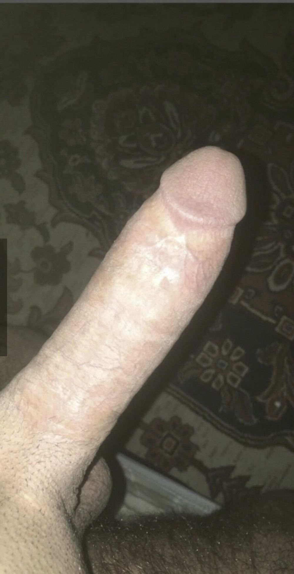 My penis