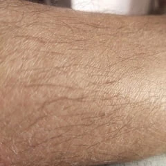 Hot 