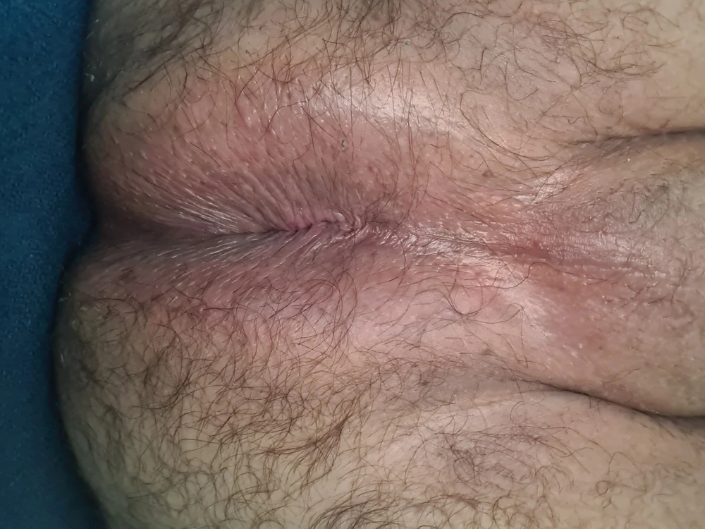 foto3