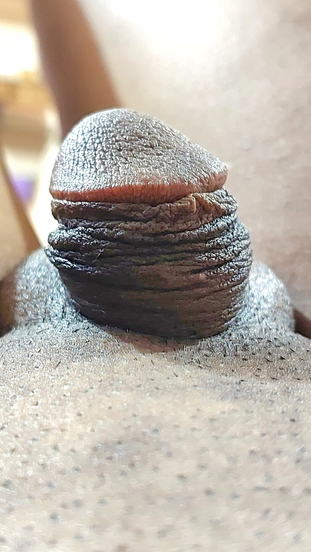 Micro penis #2