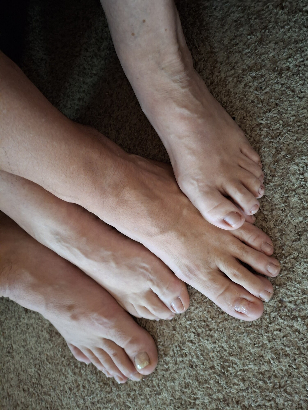 Showing off our un polished toes #7