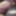 Tugging my foreskin - Foreskin restoration - Aug 2025 #3