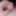 Close up foreskin and glans #3