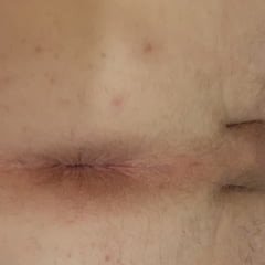 我的屁股