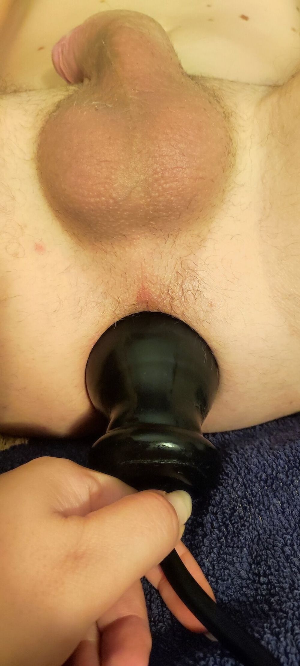 Anal Inflatable Dilation of the Naughty Husband  #5