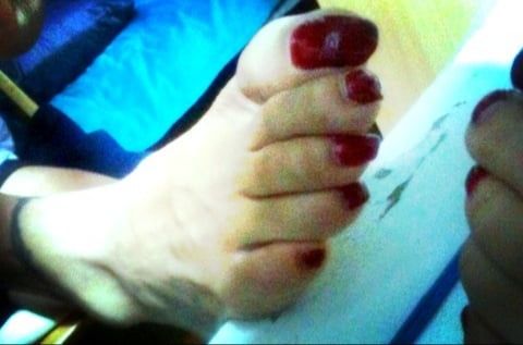 Asian ts feets, soles, toenails mix #31