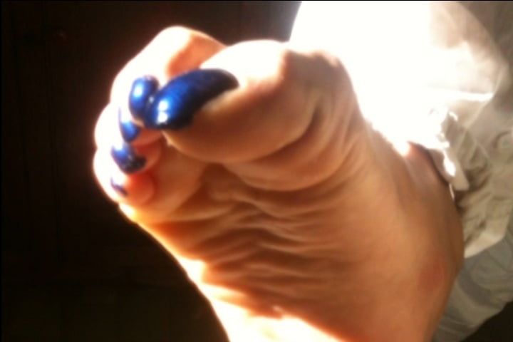 Blue toenails under sun ray #19
