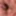 My foreskin #3