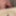 Dick Pictures 