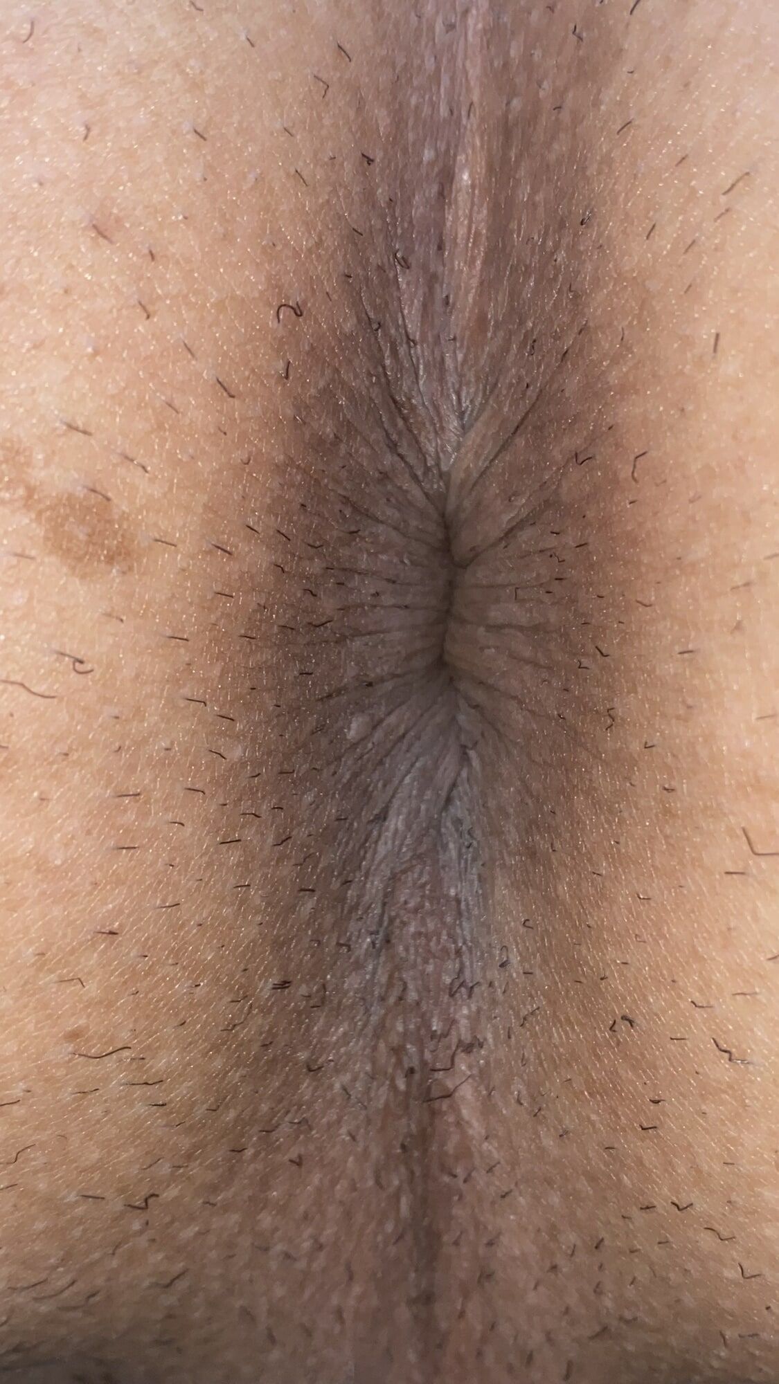 Recent anal feature
