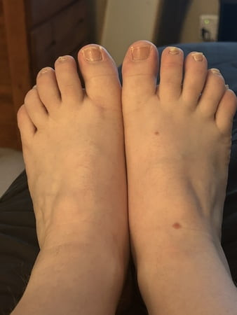 My Feet