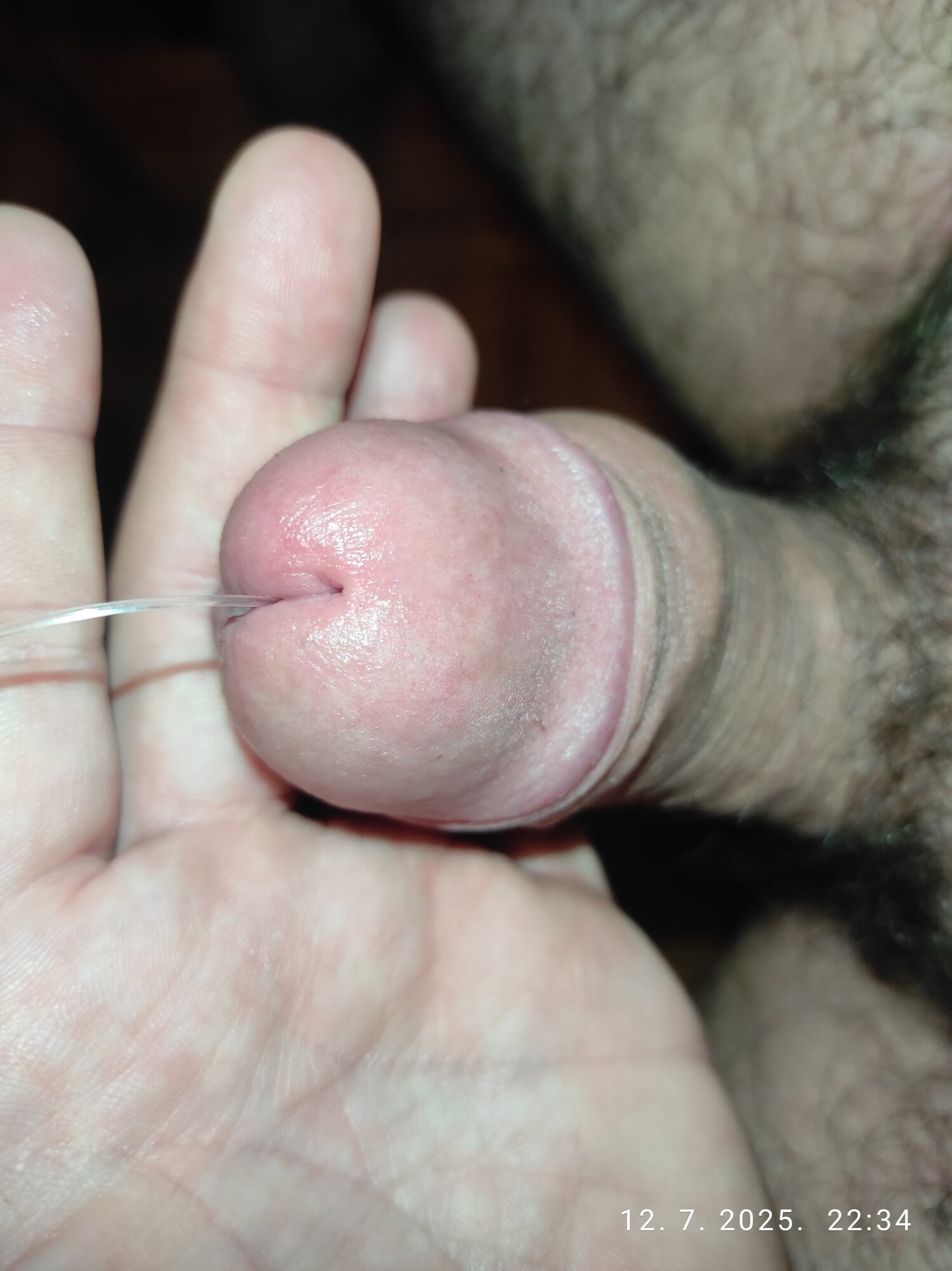 Urethra insertion #3