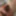 extended foreskin #3