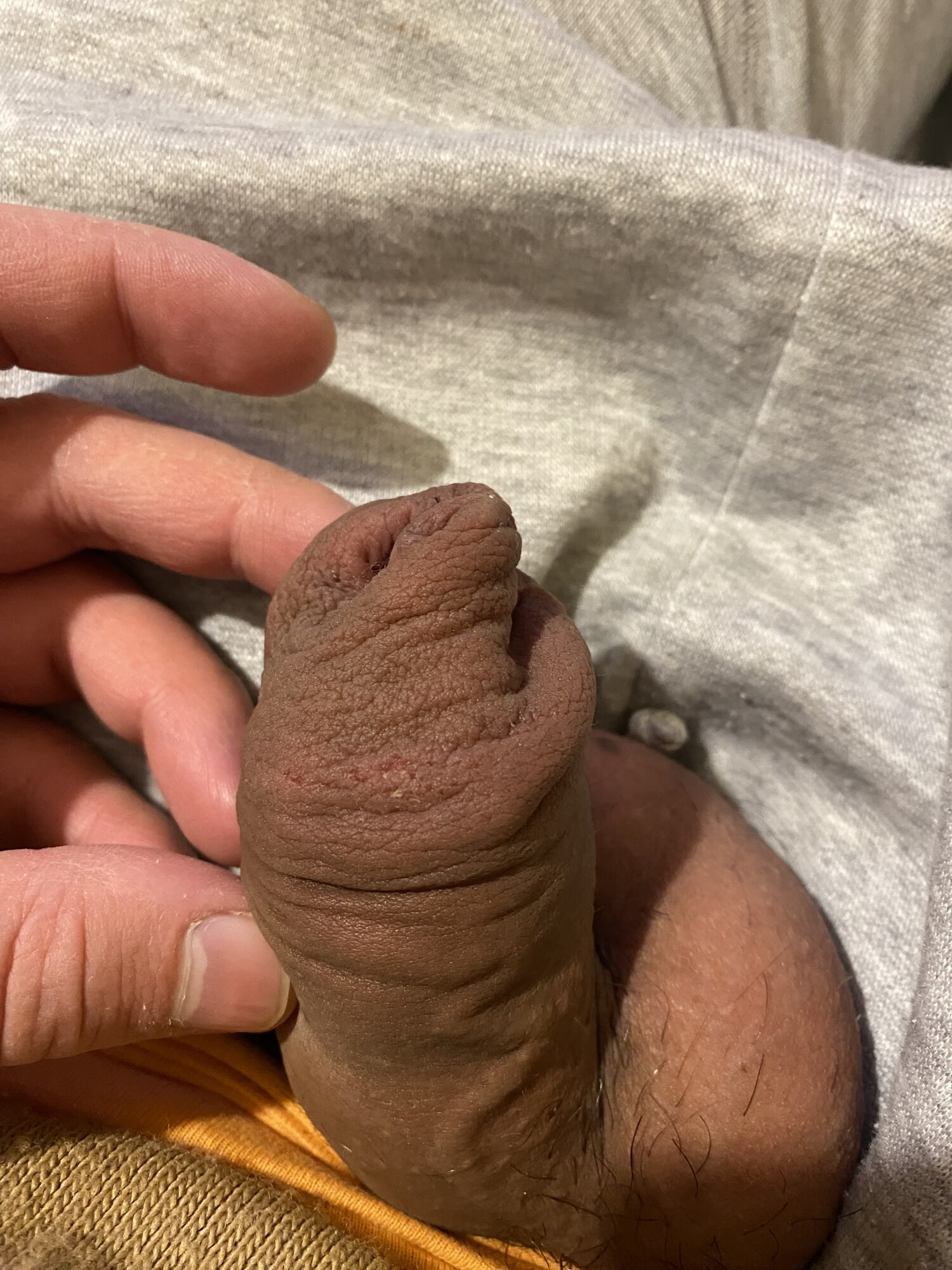 Overhang kulup