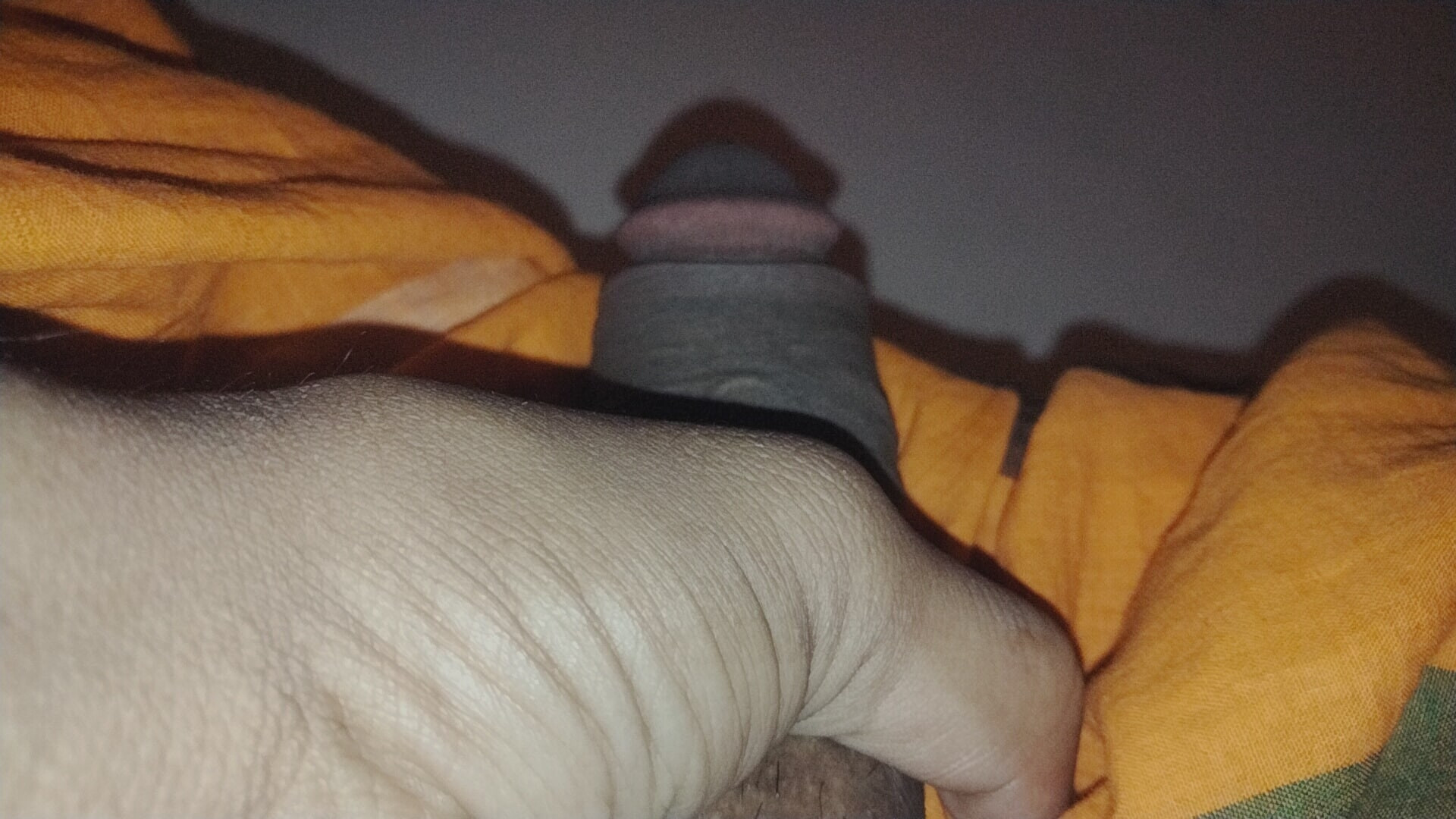 Dick is swollen and the veins are sticking out