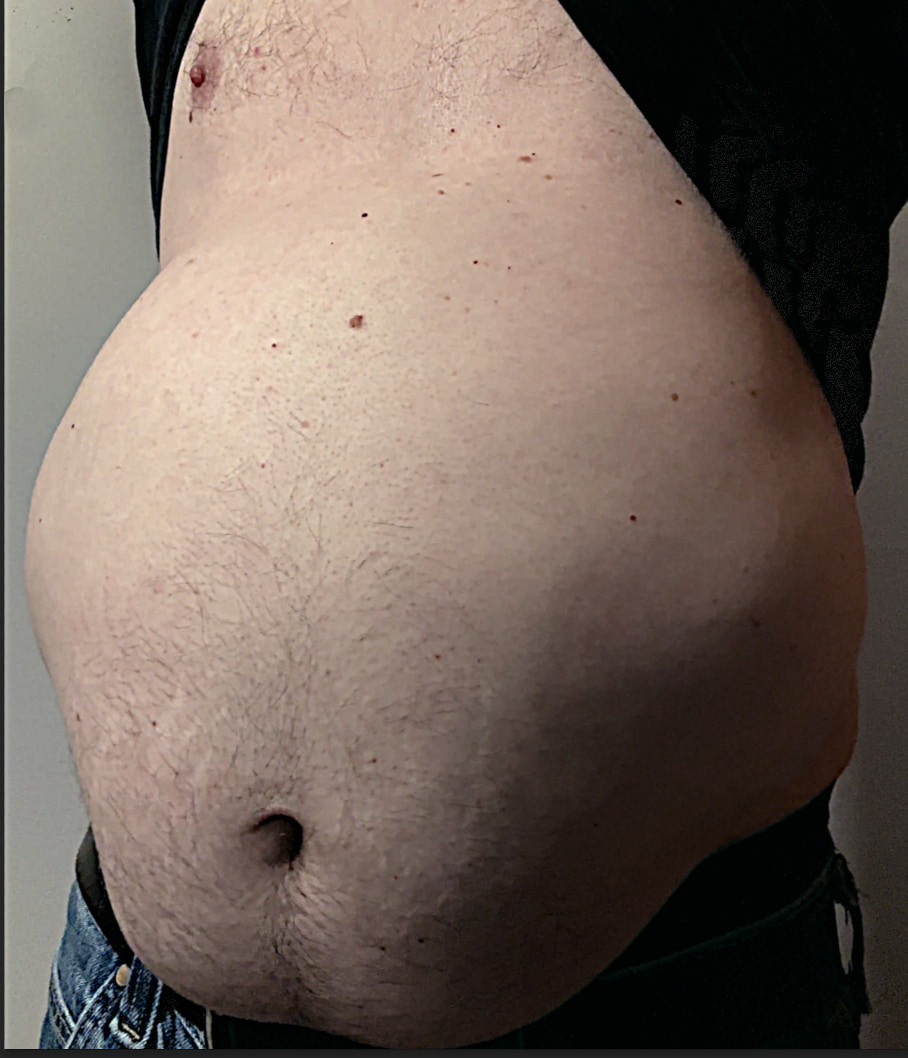 Ximd9000 Big Bloated Belly #22