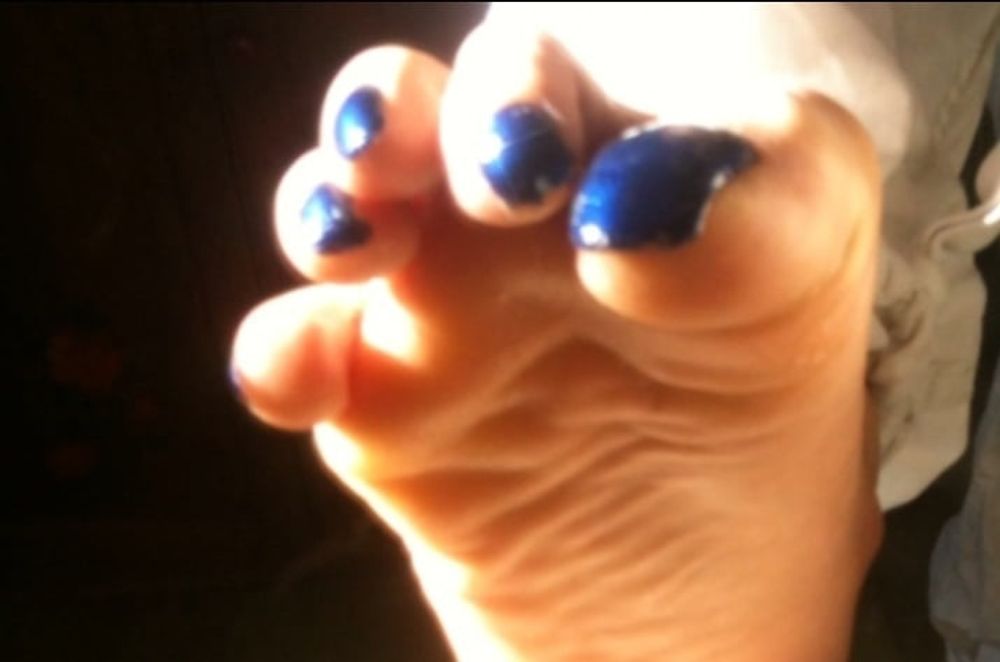 Blue toenails under sun ray #21