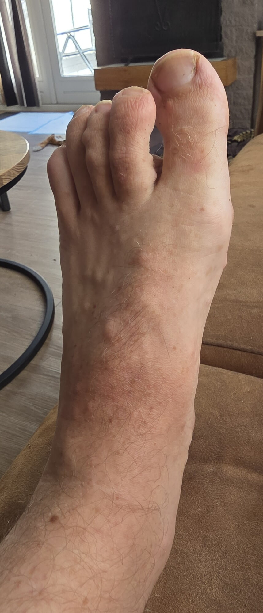 My feet #6