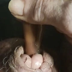 Catheter 