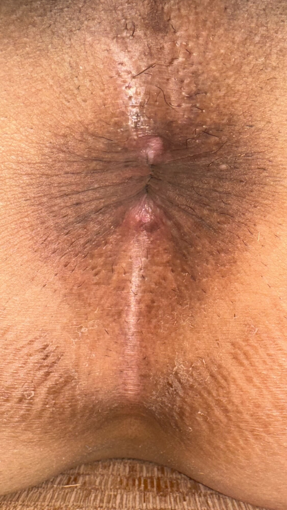 my  anus #32